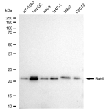 KD-Validated Rab9 Rabbit mAb (20 μl)