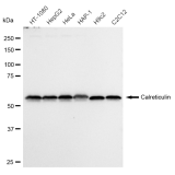 KD-Validated CRT Rabbit mAb (20 μl)