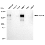 KD-Validated MERTK Rabbit mAb (20 μl)