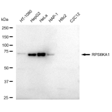 KD-Validated RPS6KA1 Rabbit mAb (20 μl)