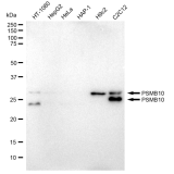 KD-Validated PSMB10 Rabbit mAb (20 μl)