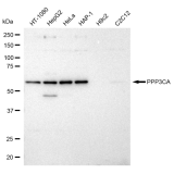 KD-Validated PPP3CA Rabbit mAb (20 μl)