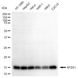 KD-Validated AP2S1 Rabbit mAb (20 μl)