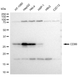 KD-Validated CD99 Rabbit mAb (20 μl)