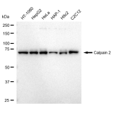 KD-Validated CAPN2 Rabbit mAb (20 μl)