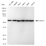 KD-Validated CDC73 Rabbit mAb (20 μl)