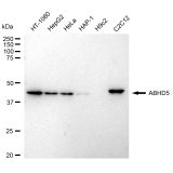 KD-Validated ABHD5 Rabbit mAb (20 μl)