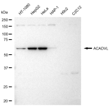 KD-Validated ACADVL Rabbit mAb (20 μl)