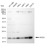KD-Validated AP2S1 Rabbit mAb (20 μl)