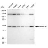 KD-Validated PAFAH1B1 Rabbit mAb (20 μl)