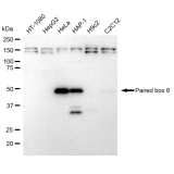 KD-Validated Paired box 6 Rabbit mAb (20 μl)