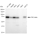 KD-Validated PRKCD Rabbit mAb (20 μl)