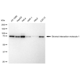 KD-Validated STIM1 Rabbit mAb (20 μl)