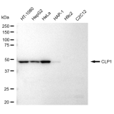 KD-Validated CLP1 Rabbit mAb (20 μl)