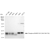 KD-Validated Phospho-eIF4EBP1/2/3 (T46+T46+T32) Rabbit mAb (20 μl)