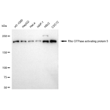 KD-Validated ARHGAP5 Rabbit mAb (20 μl)