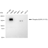 KD-Validated Phospho-EGFR (Y1173) Rabbit mAb (20 μl)