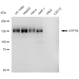 KD-Validated ATP7B Rabbit mAb (20 μl)