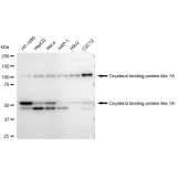KD-Validated OSBPL1A Rabbit mAb (20 μl)