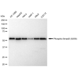 KD-Validated Phospho-Smad2 (S250) Rabbit mAb (20 μl)