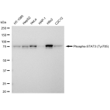 KD-Validated Phospho-STAT3 (Tyr705) Rabbit mAb (20 μl)