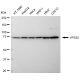 KD-Validated VPS35 Rabbit mAb (20 μl)