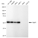 KD-Validated Atg4C Rabbit mAb (20 μl)