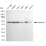 KD-Validated CASP2 Rabbit mAb (20 μl)