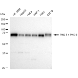 KD-Validated PRKCD Rabbit mAb (20 μl)