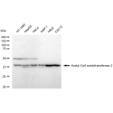 KD-Validated ACAT2 Rabbit mAb (20 μl)