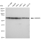 KD-Validated HNRNPK Rabbit mAb (20 μl)
