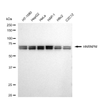 KD-Validated HNRNPM Rabbit mAb (20 μl)