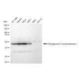 KD-Validated DGAT1 Rabbit mAb (20 μl)