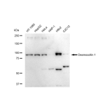 KD-Validated DSC1 Rabbit mAb (20 μl)