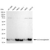 KD-Validated B2M Rabbit mAb (20 μl)