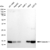 KD-Validated LGALS1 Rabbit mAb (20 μl)