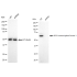 KD-Validated E2F1 Rabbit mAb (20 μl)