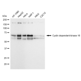 KD-Validated CDK16 Rabbit mAb (20 μl)