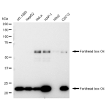 KD-Validated FOXO4 Rabbit mAb (20 μl)
