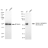 KD-Validated G6PD Rabbit mAb (20 μl)