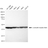 KD-Validated ACTSA Rabbit mAb (20 μl)