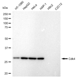 KD-Validated Cdk4 Rabbit mAb (20 μl)