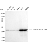 KD-Validated ACTSA Rabbit mAb (20 μl)