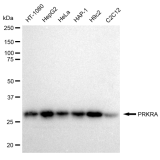 KD-Validated PRKRA Rabbit mAb (20 μl)