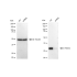 KD-Validated PRKRA Rabbit mAb (20 μl)