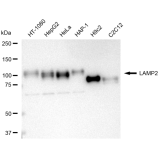 KD-Validated LAMP2 Rabbit mAb (20 μl)