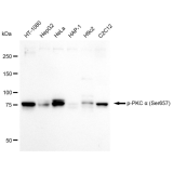 KD-Validated Phospho-PKC alpha (Ser657) Rabbit mAb (20 μl)
