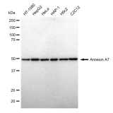 KD-Validated ANX7 Rabbit mAb (20 μl)