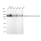 KD-Validated ABPP Rabbit mAb (20 μl)