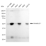 KD-Validated ARRB1 Rabbit mAb (20 μl)
